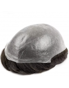 Hair Replacement Systems